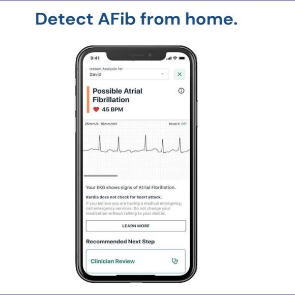 KARDIA MOBILE Personal EKG Monitor with Blue Protective Case - EUC - Picture 8 of 13
